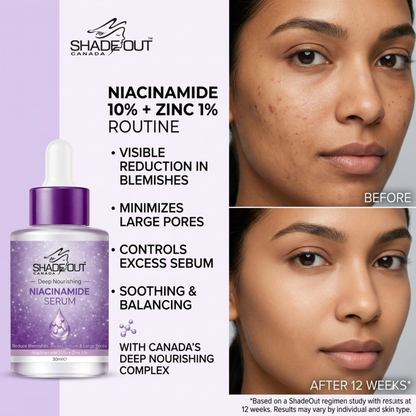 Niacinamide Serum